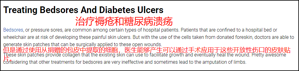 男性被割下的13亿块包皮,究竟去了哪里?(组图) - 8