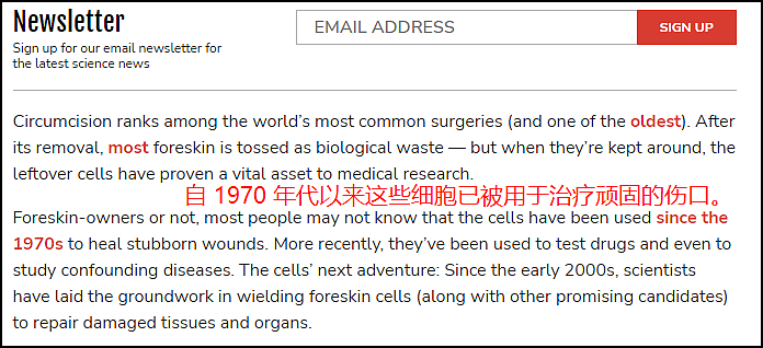 男性被割下的13亿块包皮,究竟去了哪里?(组图) - 9