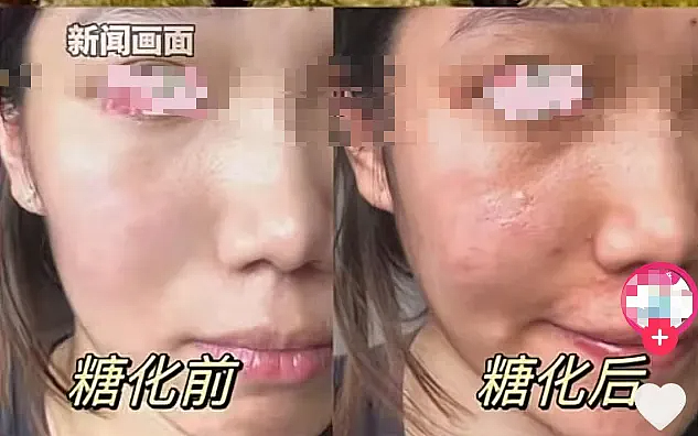 “彻底迷上了，每天下班买几串......”突然爆火，第一批“受害者”已出现，医生紧急提醒（组图） - 1