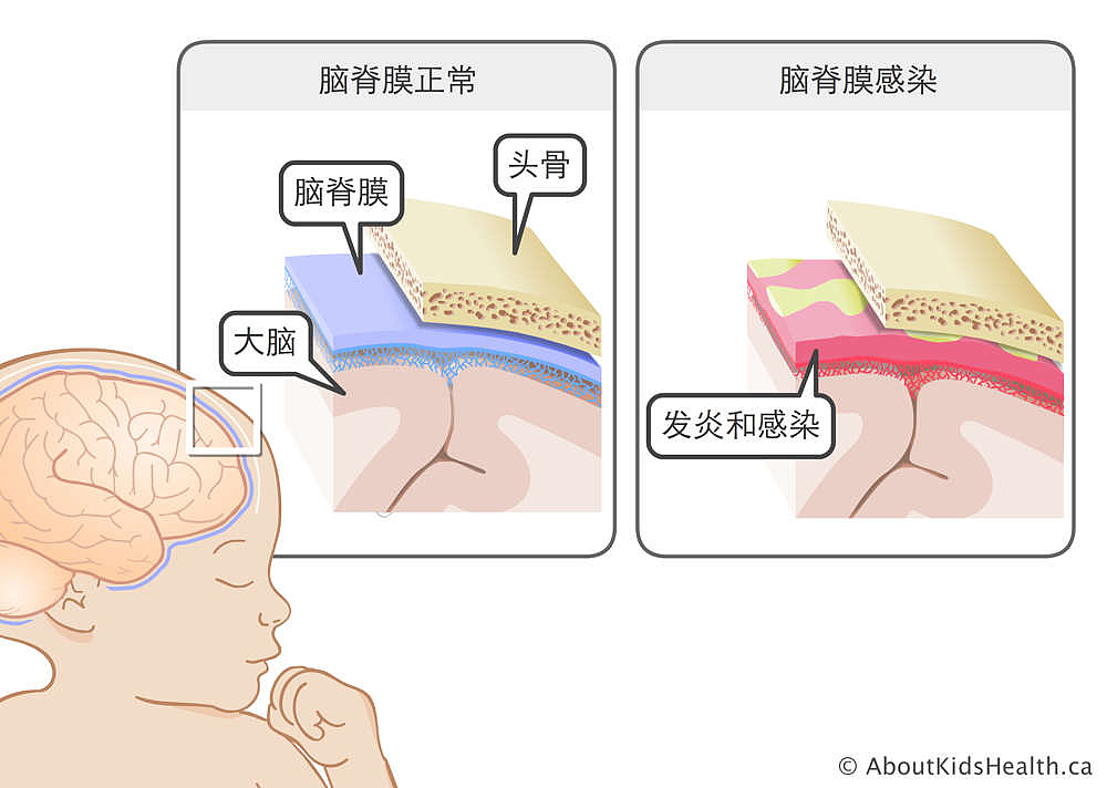 恐怖病毒席卷英国！数小时内即可蔓延，女子淋雨十几分钟后就确诊？官方提醒注意...（组图） - 6