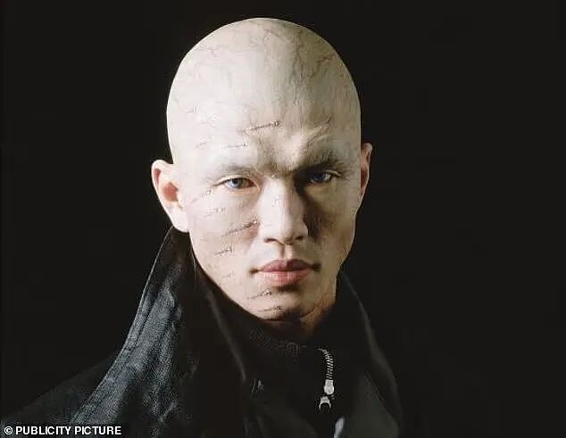 闪瞎眼!失明小哥用2克拉钻石打造闪亮义眼,200万美元挂脸上,真刺激...(组图) - 13