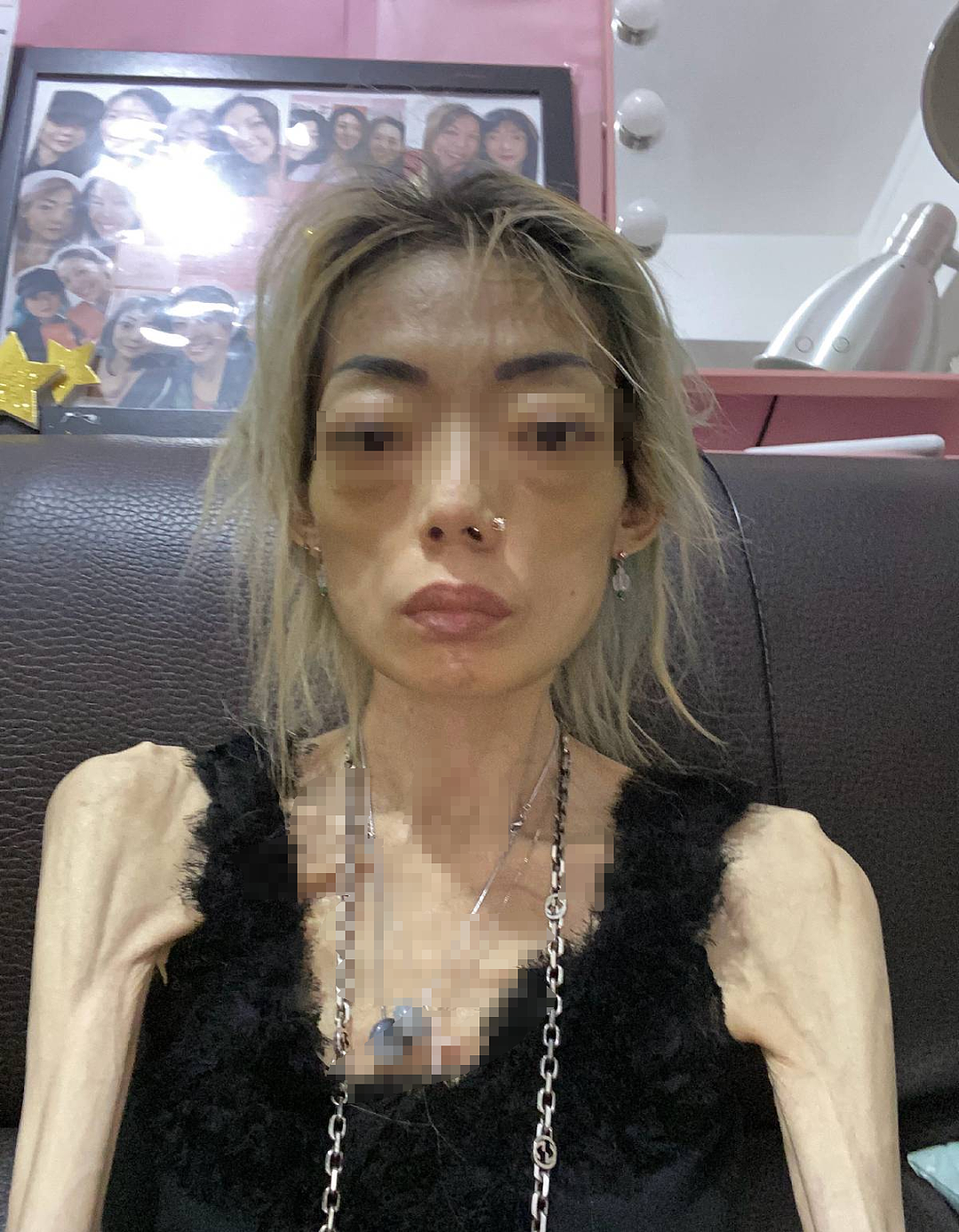 女模特嫁入豪门后成玩物暴瘦44斤成骷髅？经历和颜值对比让人泪崩（组图） - 1