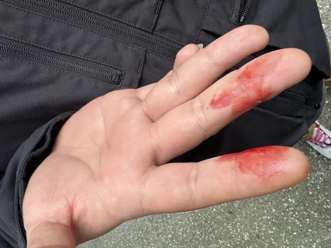 中国留学生在奥克兰市中心被打!“感觉被新西兰骗了……为了签证,只能忍”(组图) - 3
