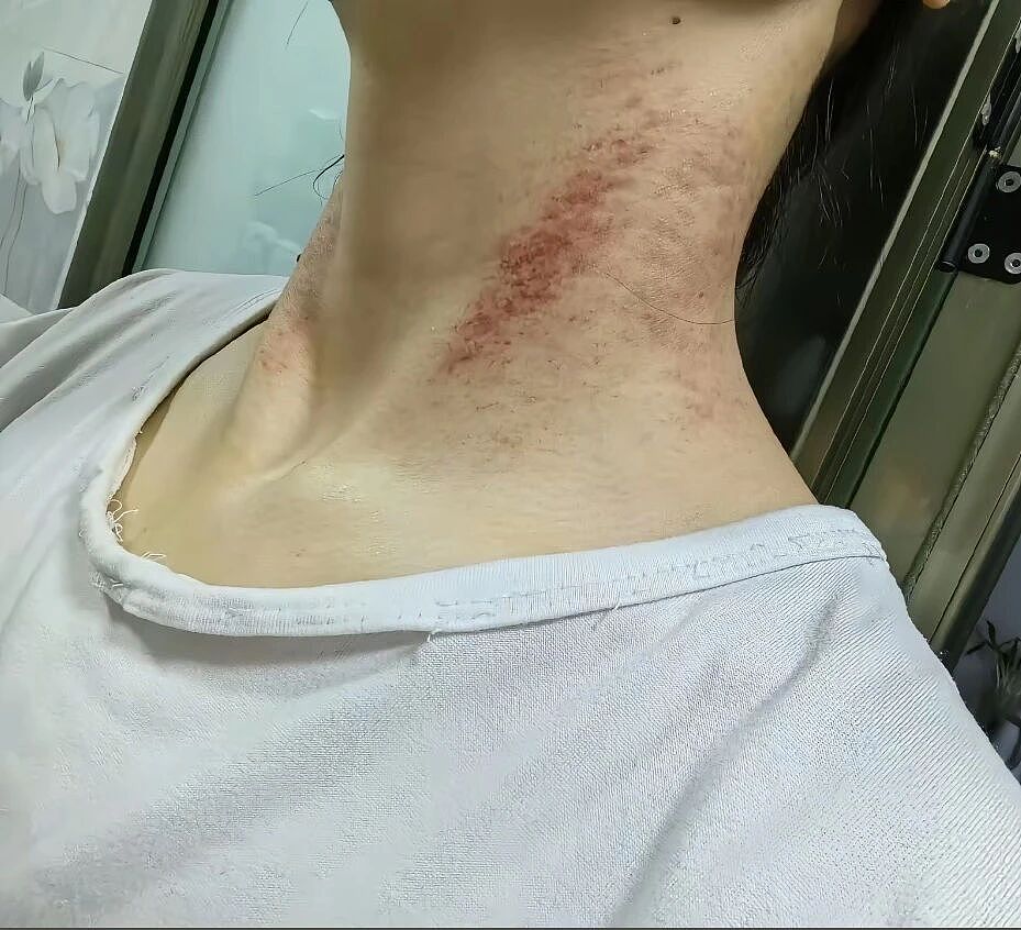 从家暴到割喉，西安女护士五年的漫长死亡（组图） - 3