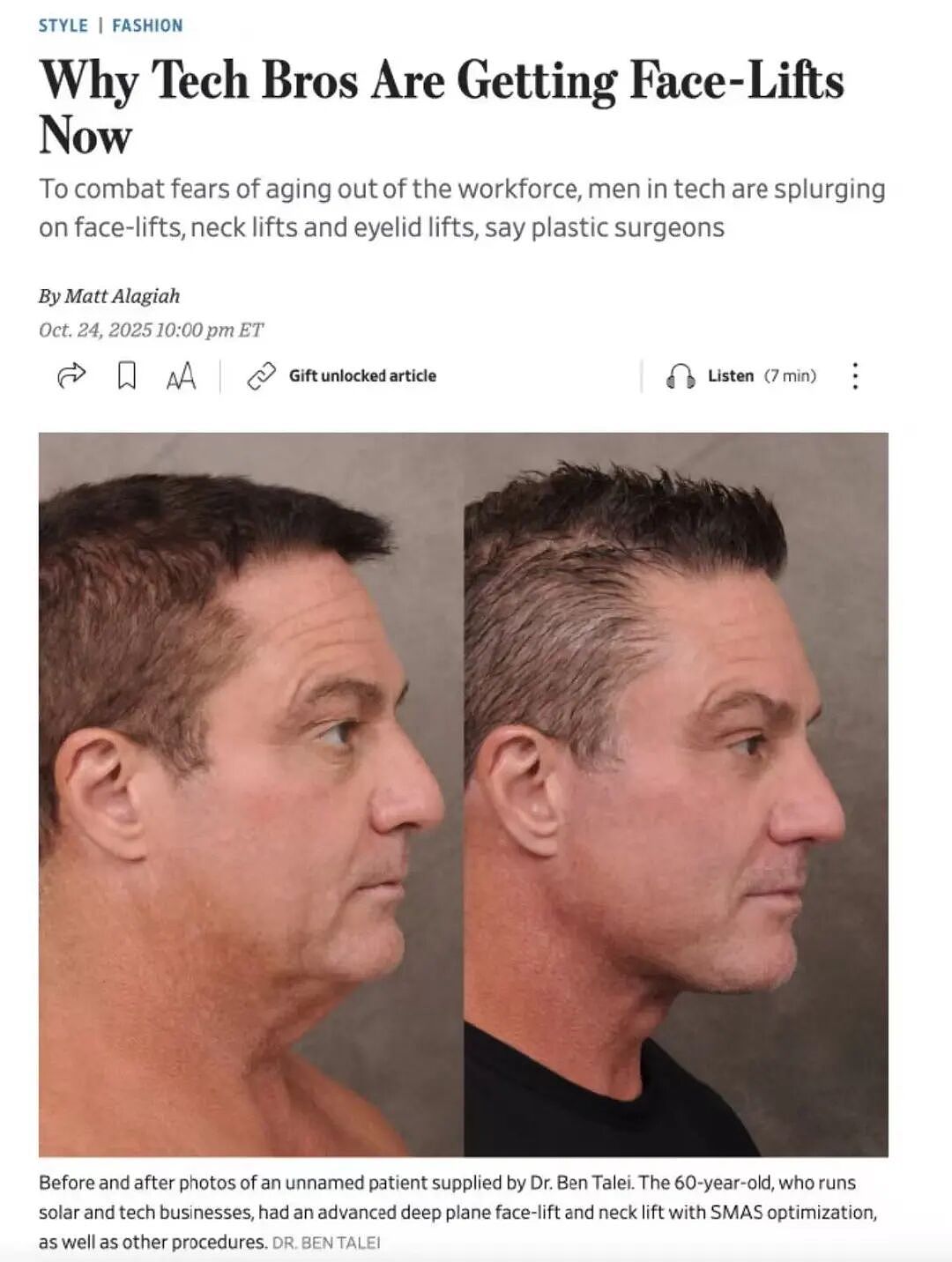 中国男人扎堆往医美上砸钱，“以前怕被说娘，现在只怕丑”（组图） - 1