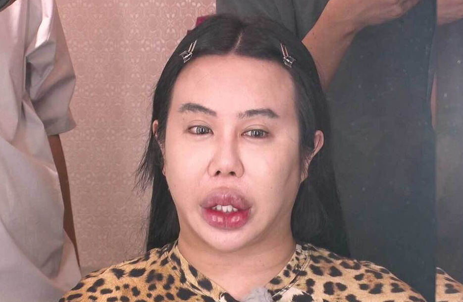 吓！星二代遭霸凌砸1亿变“整容怪”！烈焰红唇超抽象还得暴食症，网友：脸都融化了（组图） - 16