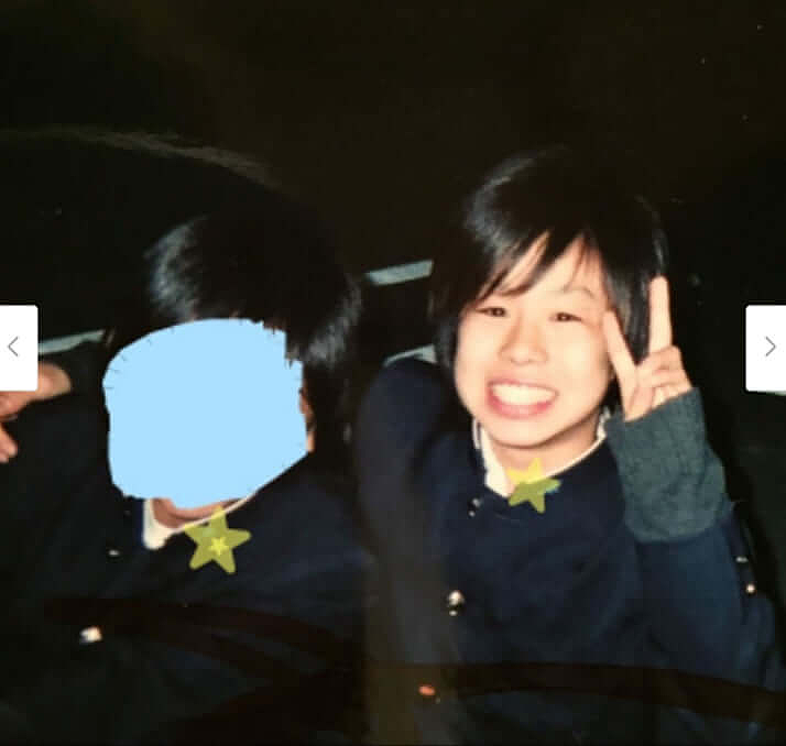 吓！星二代遭霸凌砸1亿变“整容怪”！烈焰红唇超抽象还得暴食症，网友：脸都融化了（组图） - 4