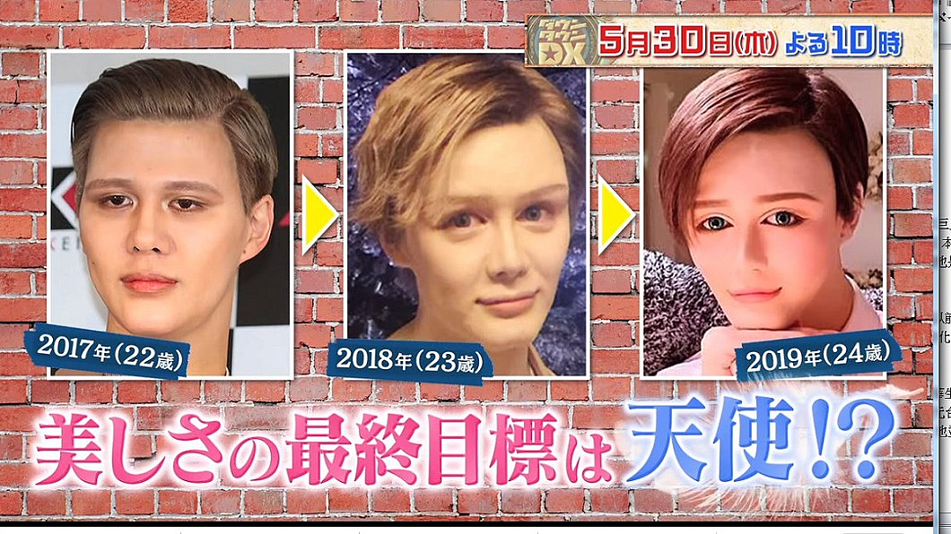吓！星二代遭霸凌砸1亿变“整容怪”！烈焰红唇超抽象还得暴食症，网友：脸都融化了（组图） - 2