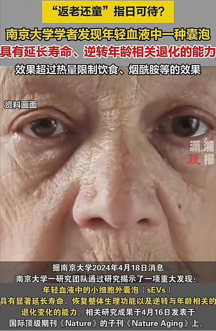 李连杰返老还童越扒越有！好友证实王宁也做了大血净，官媒早披露（组图） - 7