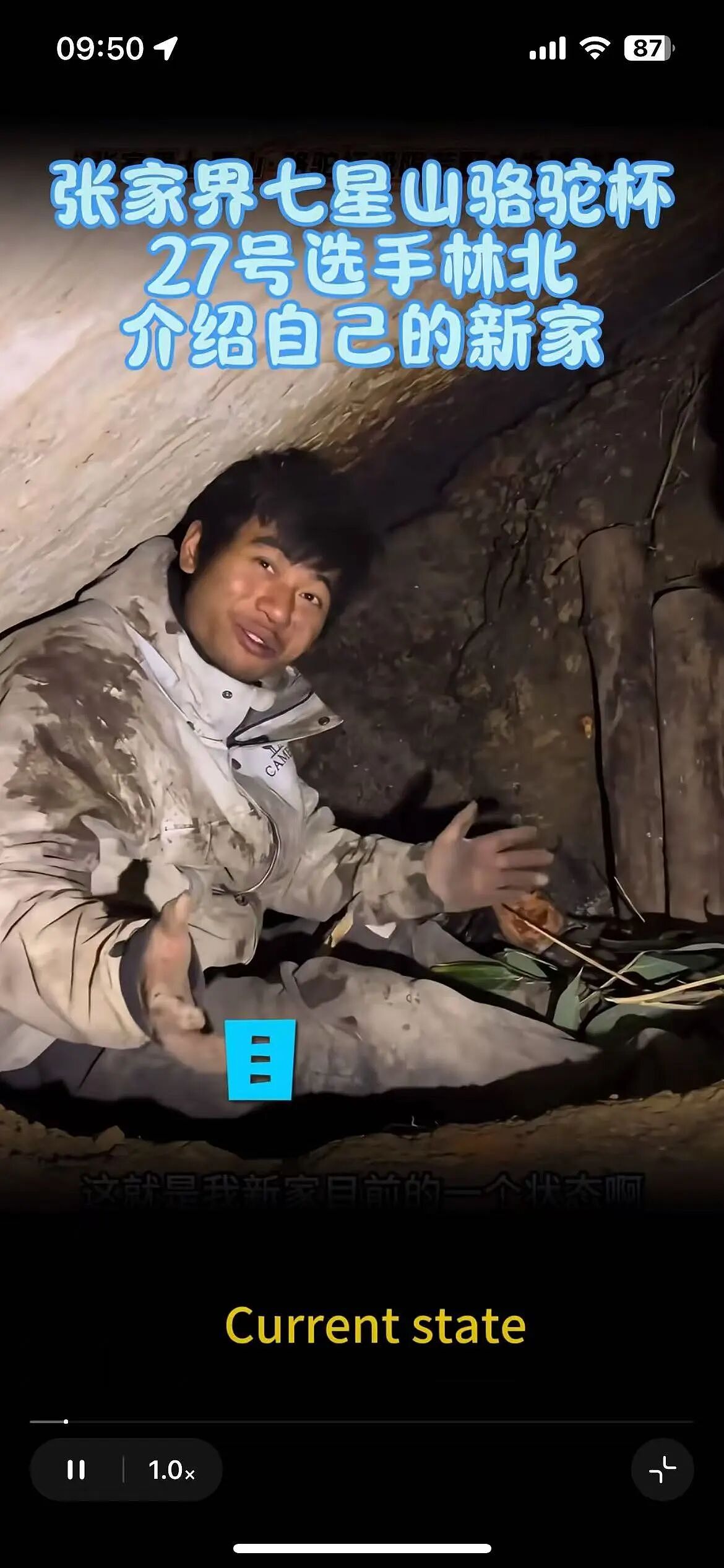 35天了,她面相大变,越来越有疯感(组图) - 4
