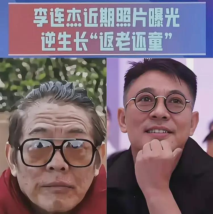 李连杰变年轻风波升级,向太和医生回应自相矛盾,外国博主曝更多(组图) - 1