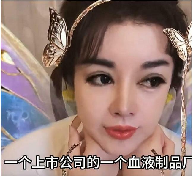 这些血从哪里来？55岁中国网红超狂抗老疗程曝光（图） - 1