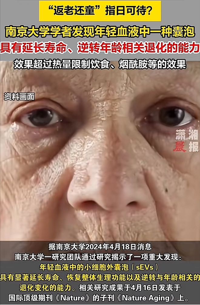 李连杰返老还童越扒越有！好友证实王宁也做了大血净，官媒早披露（组图） - 7