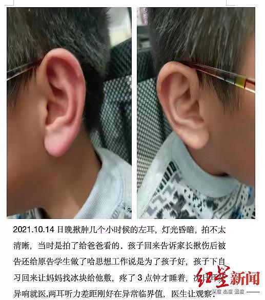 家长称初一学生遭班主任“踢打吐口水”后患心理疾病，学校：以法院判决为准（组图） - 1