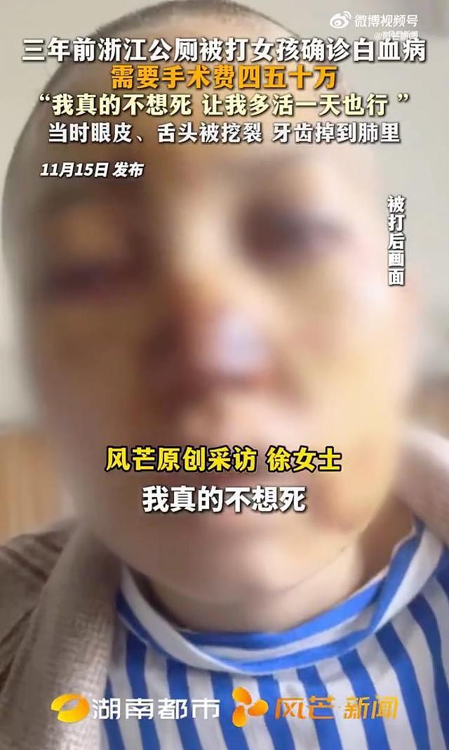 浙江公厕被殴打20分钟的女孩确诊白血病：我真的不想死（组图） - 1