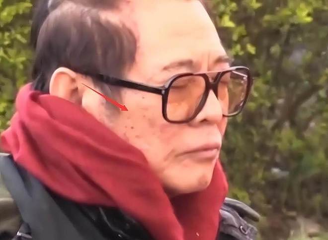 李连杰“换心”后续：向太曝更多细节，一夜回春内幕终被揭开（组图） - 2