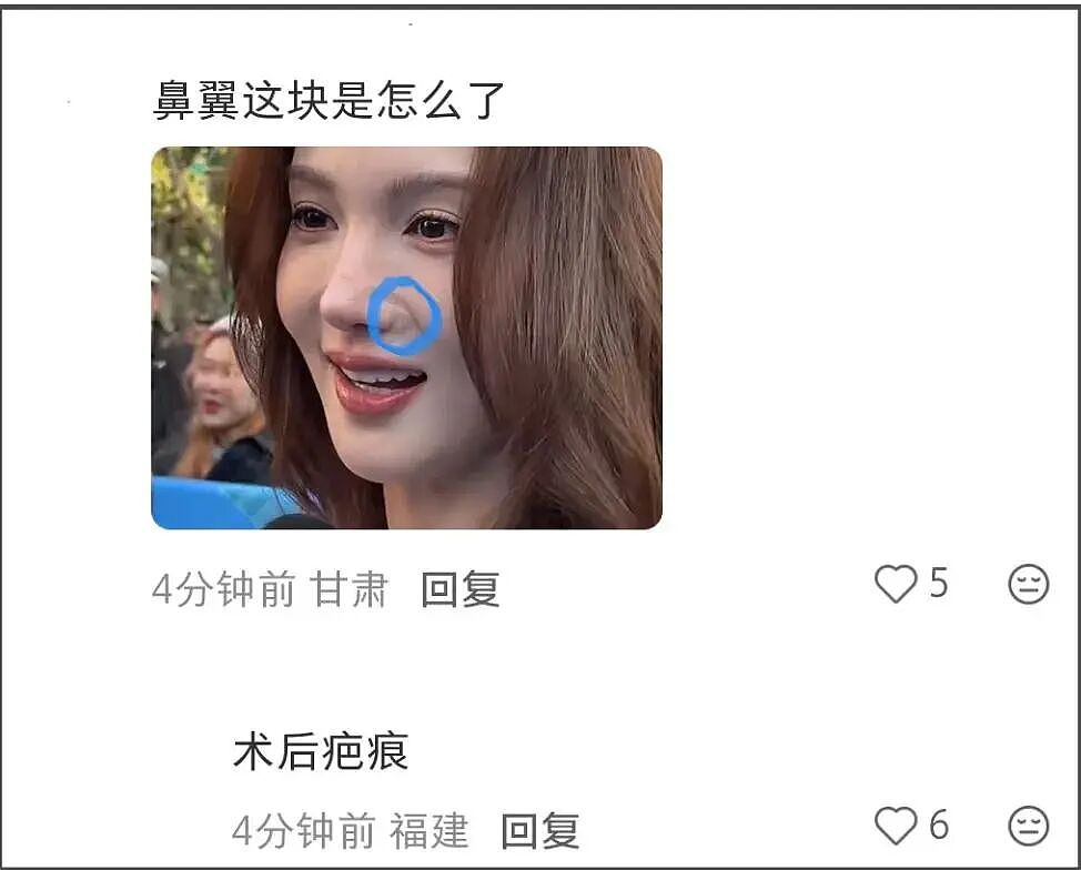 金晨怼脸拍鼻翼疤痕明显，妆浓到卡粉都遮不住，网友劝她收手（组图） - 4
