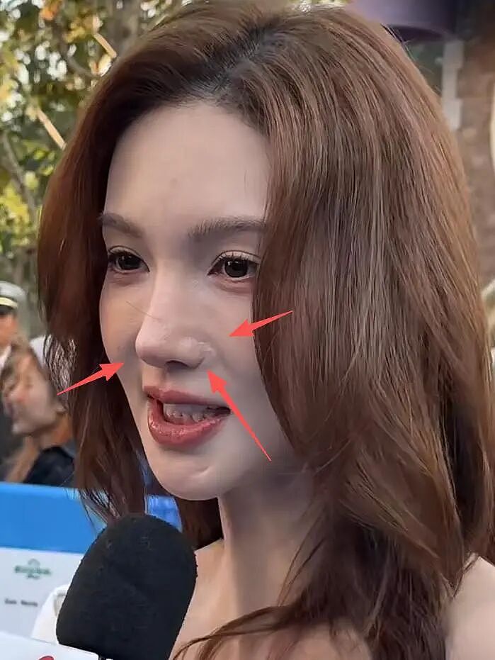 金晨怼脸拍鼻翼疤痕明显，妆浓到卡粉都遮不住，网友劝她收手（组图） - 5