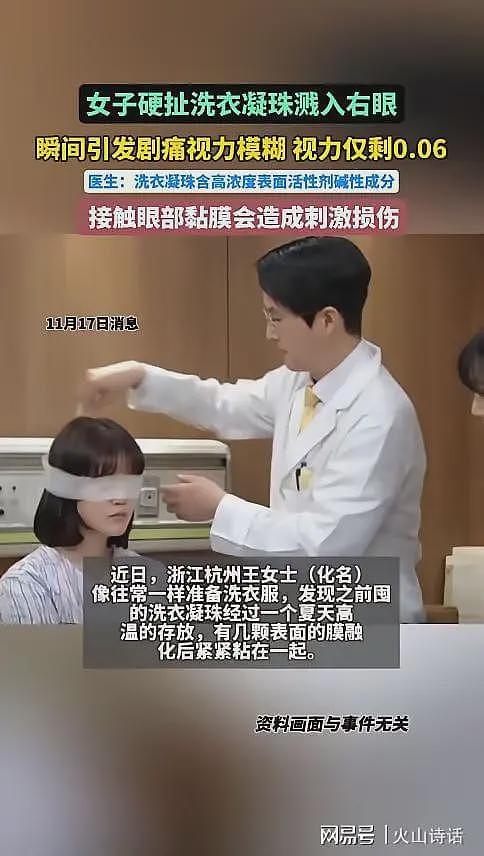 恐怖!洗衣引发“爆炸”,杭州一女子撕扯凝珠发生意外致眼睛失明(组图) - 1