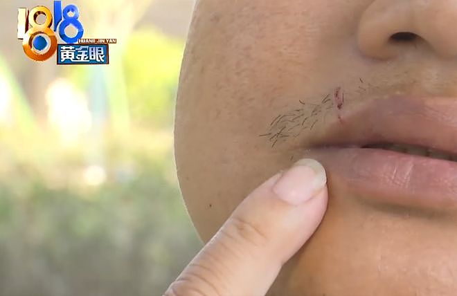 “我80多岁了，谁敢拦我？”男子景区吐槽乱插队被老人打伤，警方介入（组图） - 7