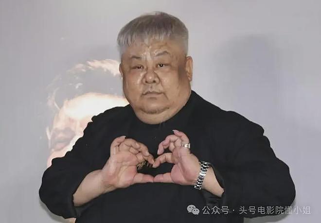 男星林雪辟谣欠债百亿,网友却发现他脸上黑斑变大,面积扩大3倍(组图) - 10