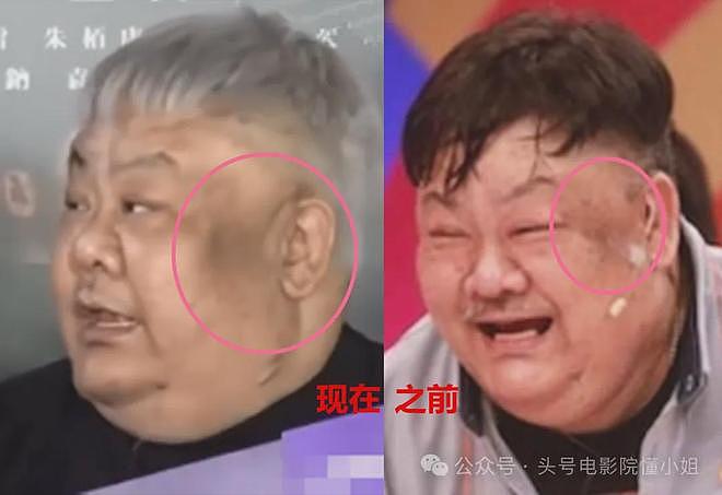 男星林雪辟谣欠债百亿,网友却发现他脸上黑斑变大,面积扩大3倍(组图) - 26
