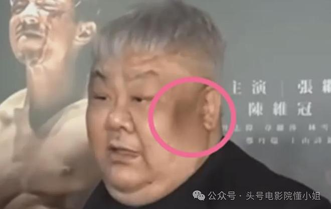男星林雪辟谣欠债百亿,网友却发现他脸上黑斑变大,面积扩大3倍(组图) - 16