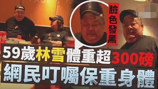 男星林雪辟谣欠债百亿,网友却发现他脸上黑斑变大,面积扩大3倍(组图) - 20