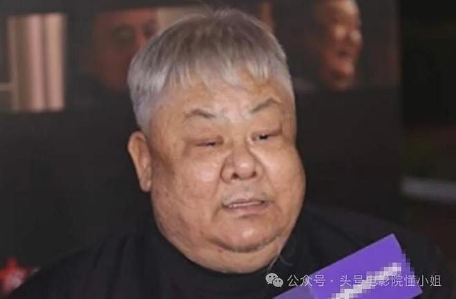 男星林雪辟谣欠债百亿,网友却发现他脸上黑斑变大,面积扩大3倍(组图) - 27