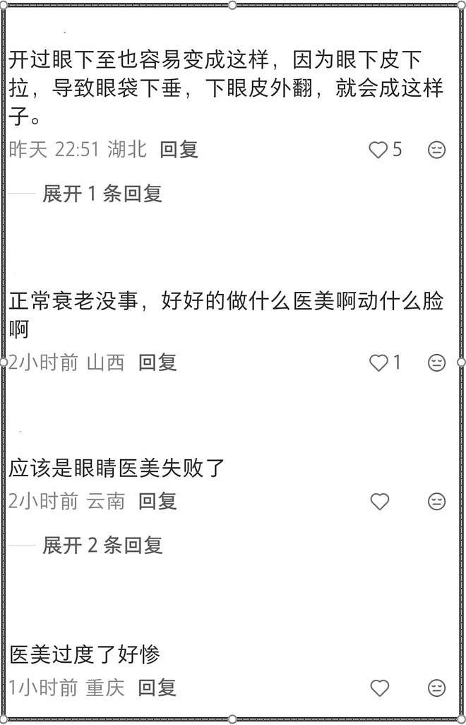 55岁古天乐近照曝光！面部浮肿眼睛又变样，断崖式衰老引热议（组图） - 9