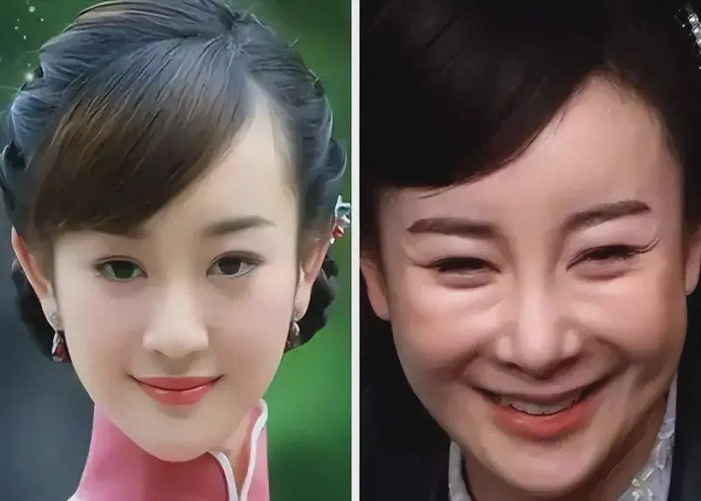 比整容还离谱!39岁江疏影现身活动,脸僵似硅胶,造型丑到认不出(组图) - 19