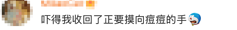 20岁男生肺被“啃”出10多个空洞！网友吓懵：原来我真的命大（组图） - 4