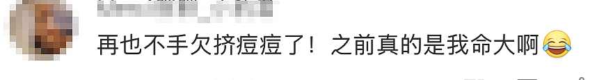 20岁男生肺被“啃”出10多个空洞！网友吓懵：原来我真的命大（组图） - 2