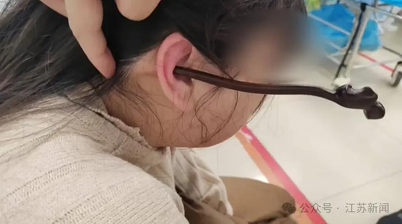 吓人！女子睡前没摘发簪，夜里翻身插入耳朵直抵后脑勺（视频/组图） - 1