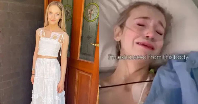 患罕见病靠输液续命!澳洲25岁女子申请安乐死:让我走吧(组图) - 1