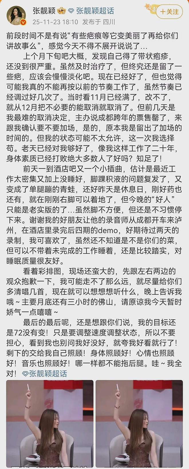 张靓颖透露患带状疱疹：虽及时治疗，还是留疤，“变成单腿蹦的青蛙”（图） - 1