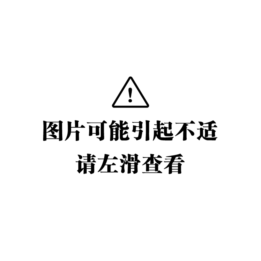 指甲长出黑线,符合这几种特征可能癌变(组图) - 2