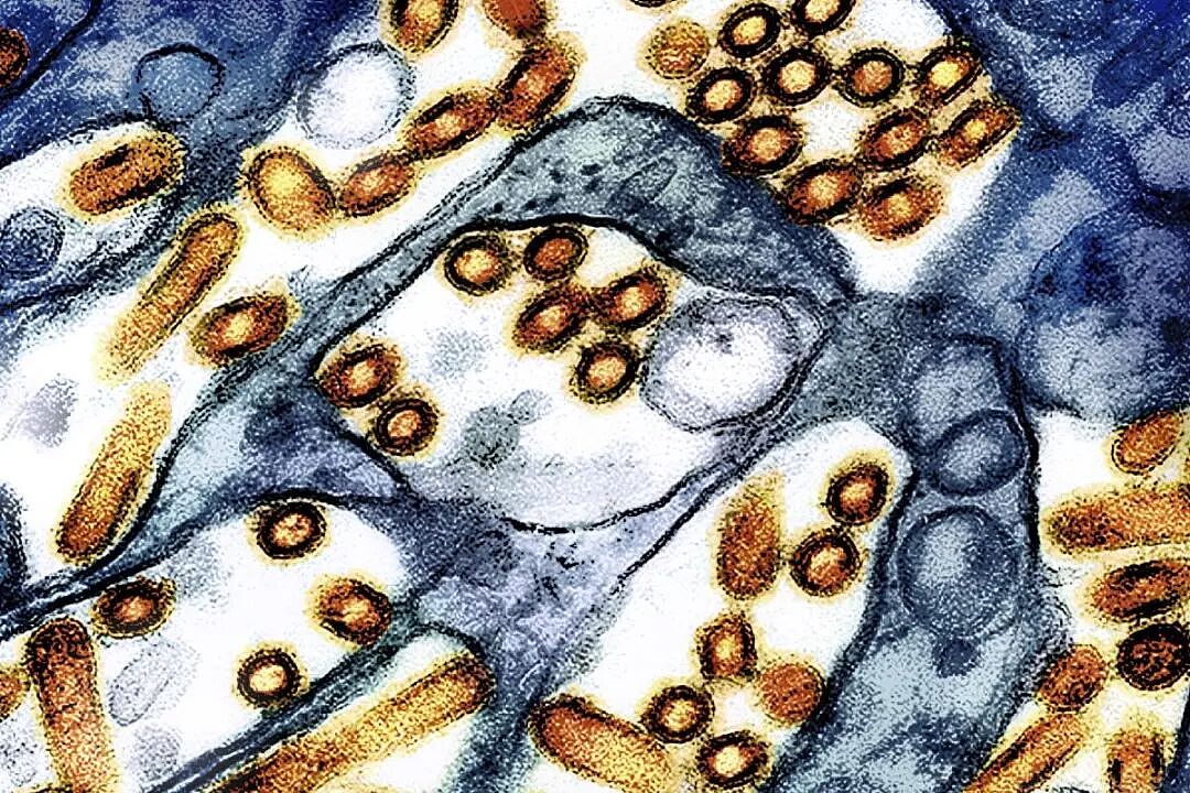 全球首例!患者感染禽流感H5N5身亡,病毒疑似来自加拿大,专家紧急示警(组图) - 3