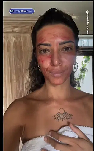 疯了！澳洲灵性疗愈师用经血做面膜，外网美妆博主争相效仿，自称提亮皮肤感觉超好？（组图） - 16