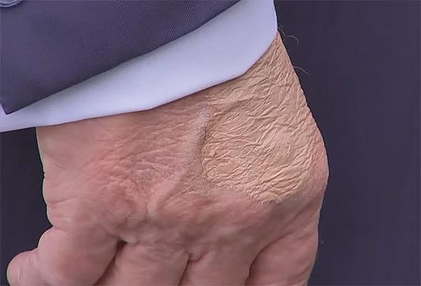 被《纽约时报》指“显露衰老迹象”,特朗普跳脚:撰稿女记者是丑八怪(图) - 1