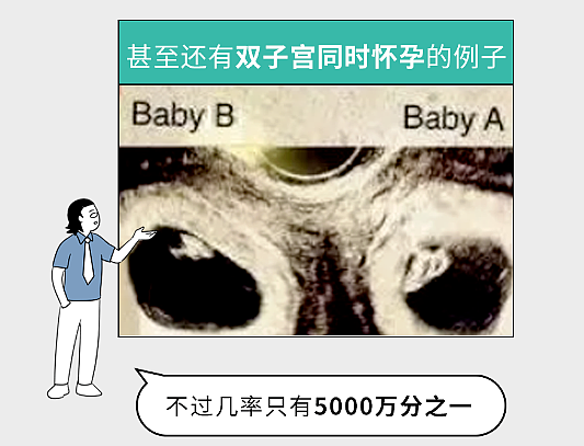 【两性】有哪些听起来特别离谱的两性知识,居然都是真的(组图) - 5