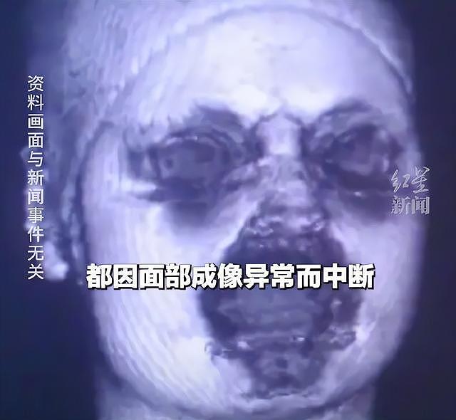 女子做头部磁共振2次黑屏竟是因为化了妆！医生：可能是她的眼影粉底等含有重金属成分或矿物成分（图） - 1