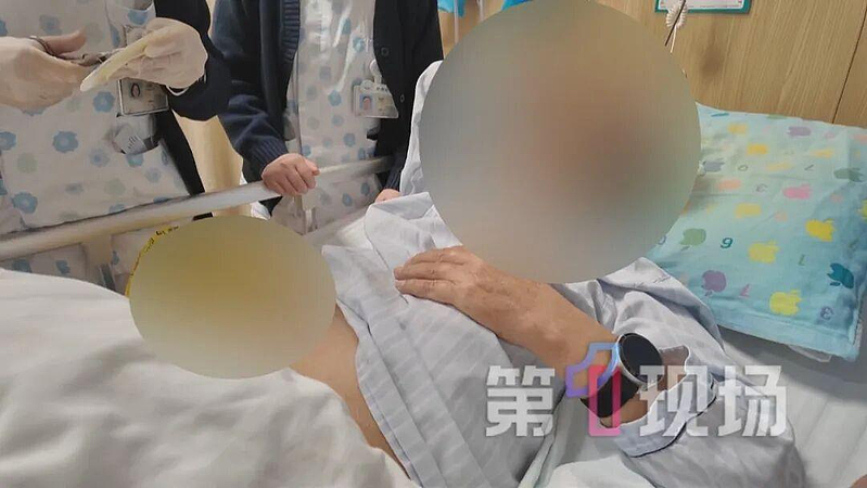 广州男便秘十多天后，口腔喷出粪便！医生：再晚一天就惨了（组图） - 1
