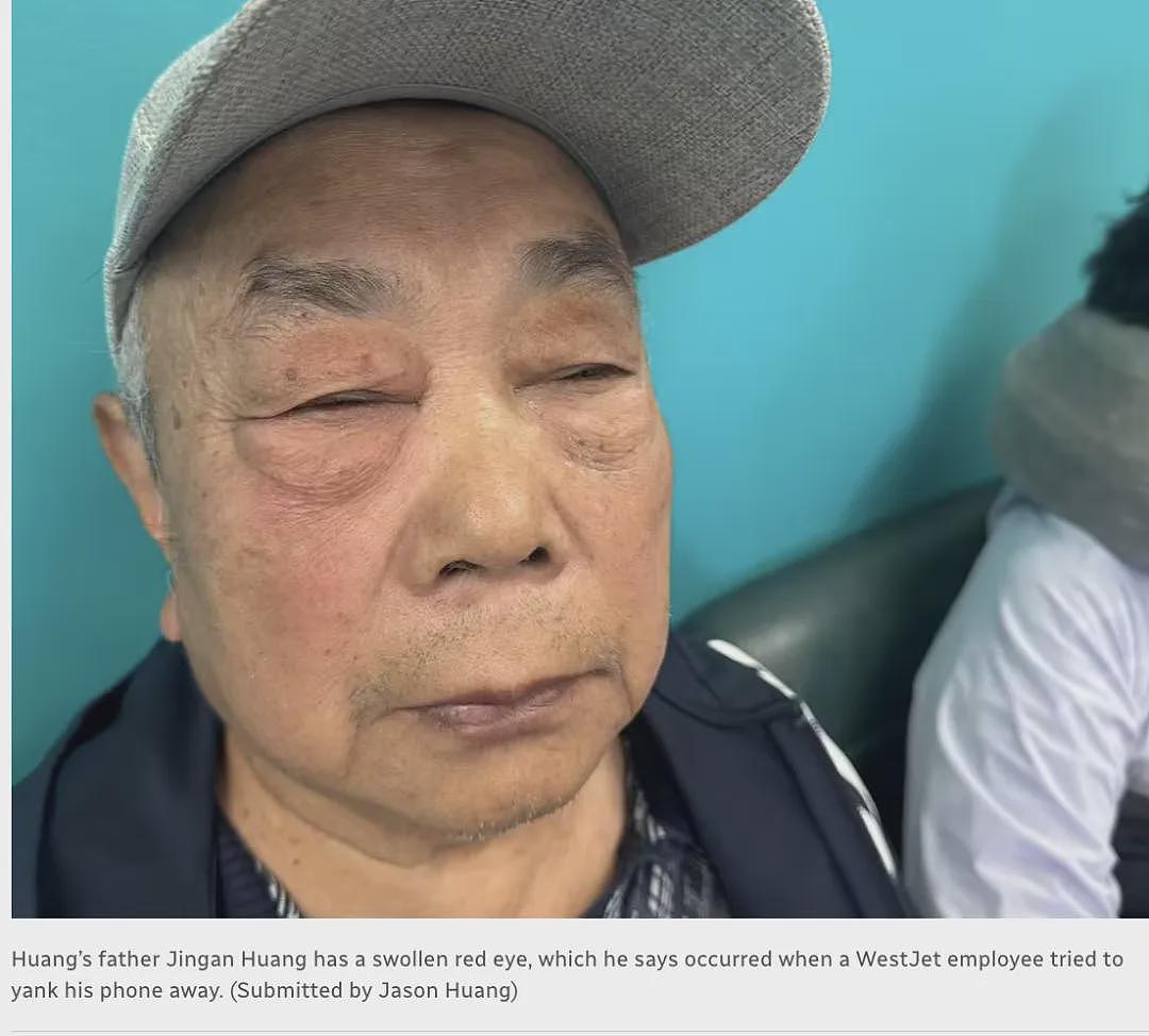 华人机场噩梦!73岁老人眼睛被员工打肿,儿子用手机录音存证被抢走,登机牌被撕烂(组图) - 3