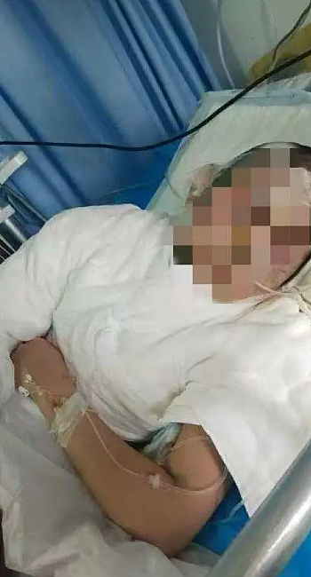 以为死了才自首:女生被前男友绑架虐待2天2夜!前后照片对比惨不忍睹(组图) - 11