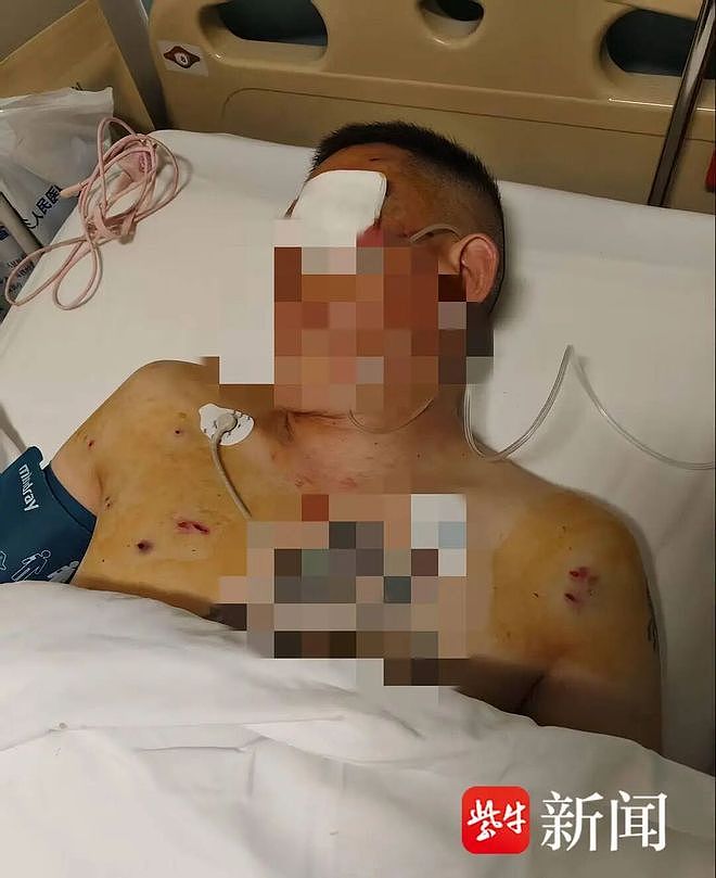 河南男子取170万元现金，在银行门口遭抢劫致重伤！当事人发声：银行工作人员和保安无动于衷，应担责（组图） - 1
