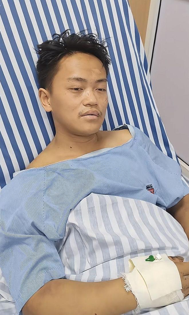中国网红在非洲遭绑架打断腿：全身水肿，双腿呈斜状态（组图） - 2