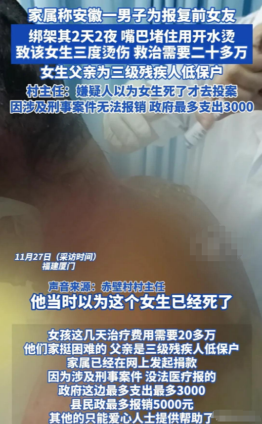 以为死了才自首:女生被前男友绑架虐待2天2夜!前后照片对比惨不忍睹(组图) - 10
