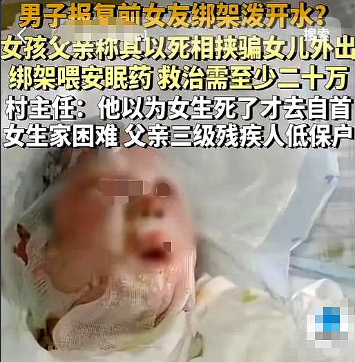 以为死了才自首:女生被前男友绑架虐待2天2夜!前后照片对比惨不忍睹(组图) - 9