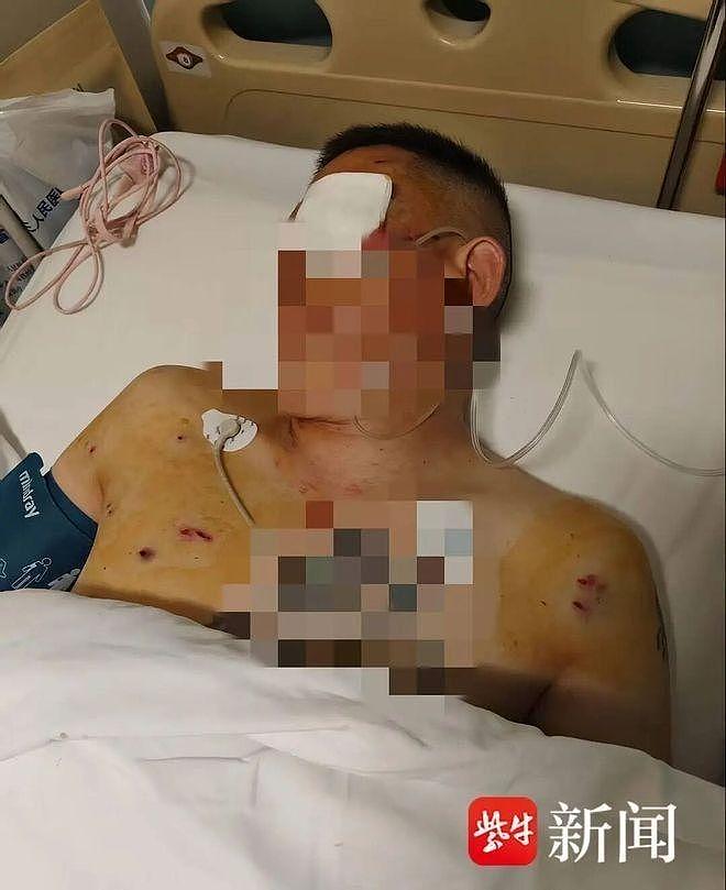 郑州男子领170万现金，银行外被抢，重伤失明后向银行索赔（组图） - 1